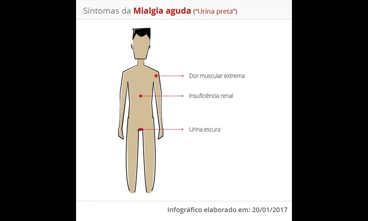 Oito casos de doença que deixa 'urina preta' foram registrados este ano na Bahia