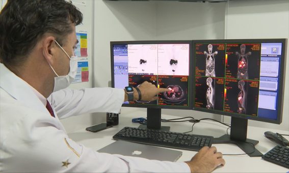 Câncer de próstata tem novo tratamento com radioterapia reduzida